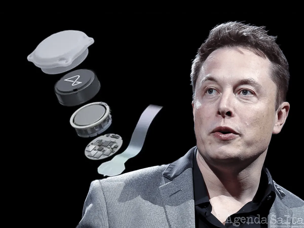 Reparos tras el anuncio de Elon Musk sobre el implante de un chip cerebral