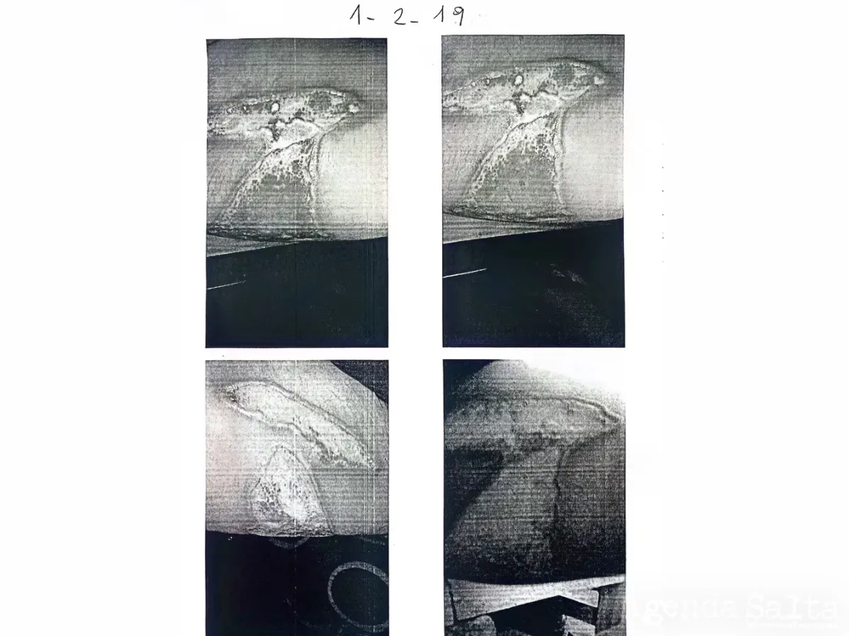 Fotos de las quemaduras de las piernas del paciente