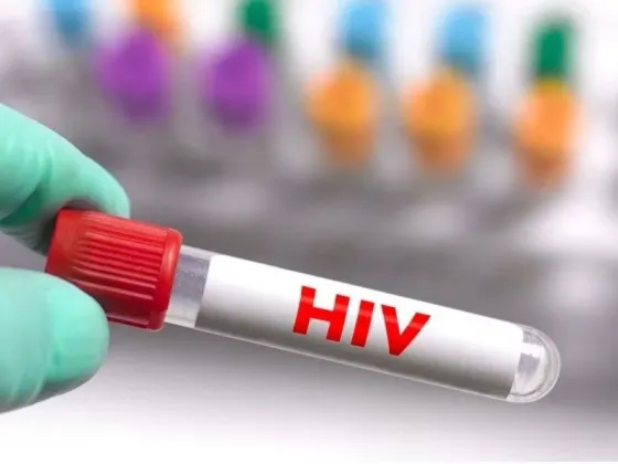 Avance contra el VIH: un tercer paciente logró controlar al virus tras un trasplante de médula