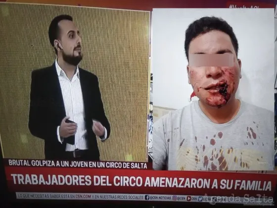 La brutal golpiza a un joven salteño en el Circo Mundial se nacionalizó