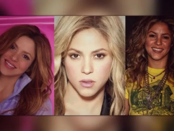 Los retoques estéticos que se habría hecho Shakira
