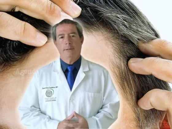 Experto en cirugía plástica advierte sobre tratamientos milagrosos para la calvicie que se ofrecen en redes sociales