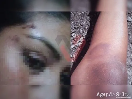 Joven salteña denuncia que habría sido drogada, golpeada y abusada