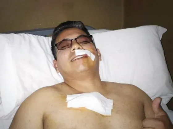 Conmoción en Salta por el feroz ataque a puñaladas a un bombero que fue a asistir en un siniestro