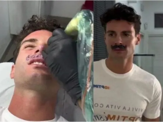 Joven se tatuó un bigote y estallaron las reacciones en TikTok