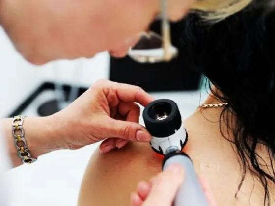ATENCIÓN: el hospital Señor del Milagro ofrece concurrencias para dermatología