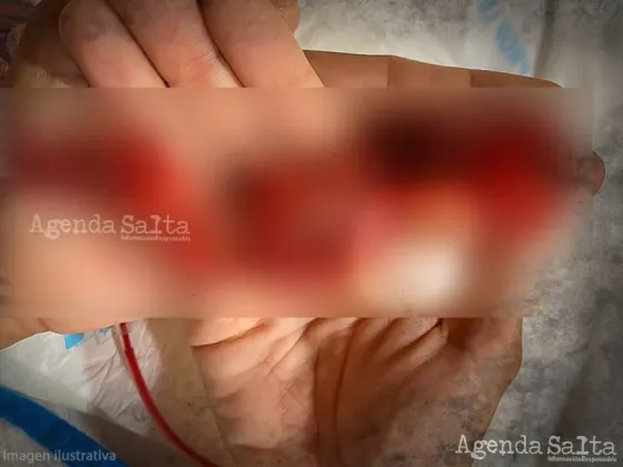 Barrio Autódromo: Hallaron un feto en una vivienda y hay una mujer internada