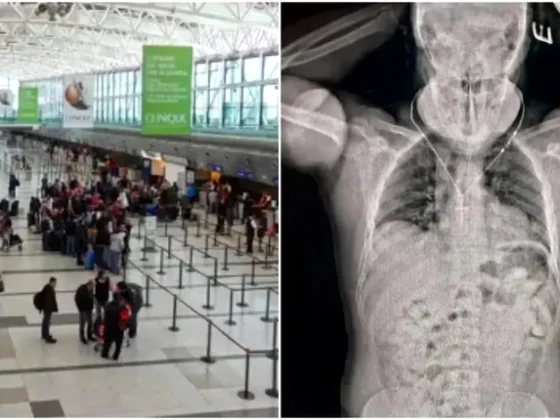 Detuvieron un brasilero que intentaba viajar a España con 84 cápsulas de cocaína en su estómago