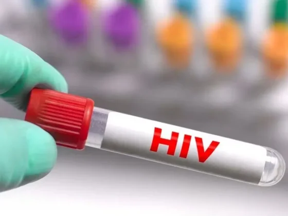 Diferencias entre VIH y SIDA: la importancia del diagnóstico precoz