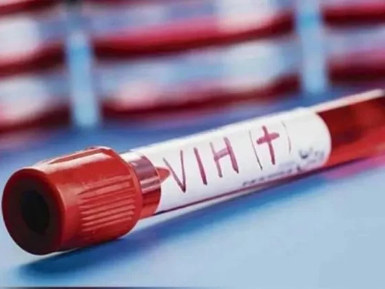Europa tiene la epidemia del VIH de más rápido crecimiento