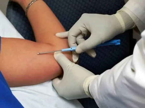 Se colocarán implantes subdérmicos en el hospital de Apolinario Saravia