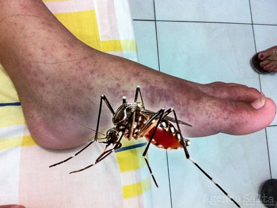 Declaran brote de Fiebre Chikungunya en el norte de Salta