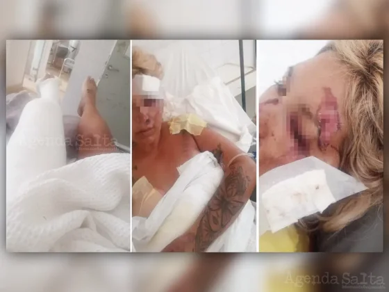 Una de las víctimas mostró cómo quedó después de ser atropellada y pide ayuda