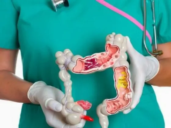 El cáncer de colon y recto detectado a tiempo es altamente curable