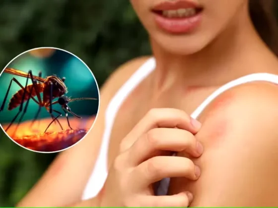 Cómo curar una picadura de mosquito sin lastimarte, según la inteligencia artificial