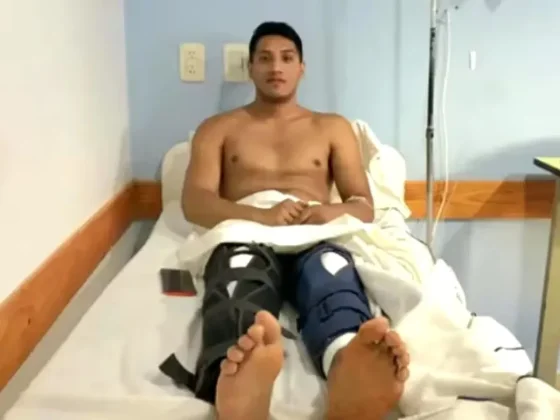 TERRIBLE: un joven fue a hacerse una cirugía en la rodilla y por error le operaron las dos piernas