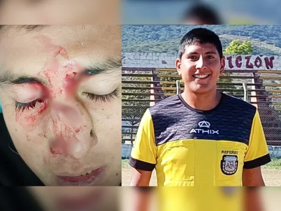 Bestia atacó a un árbitro en La Loma: cobró una falta y un jugador le fracturó la nariz