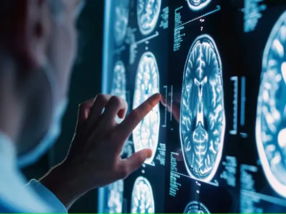 Cuatro hábitos que deterioran tu cerebro día a día, según un estudio