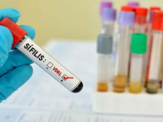 A nivel mundial se verifica un aumento en los casos de infecciones de transmisión sexual
