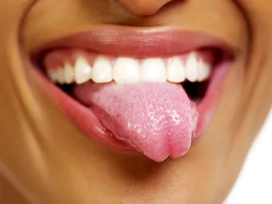 Qué significa tener la lengua blanca, según los expertos