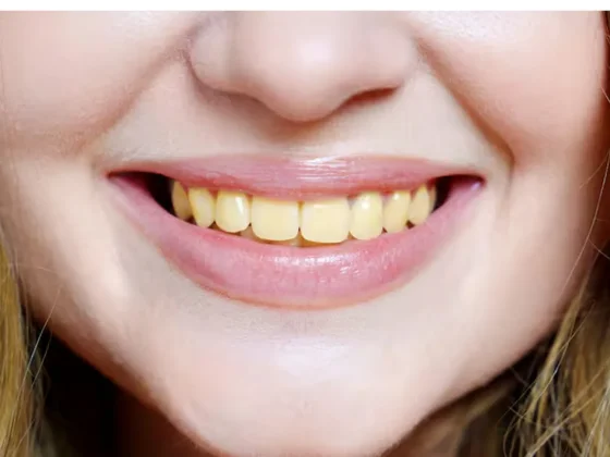 Qué significa tener los dientes amarillos