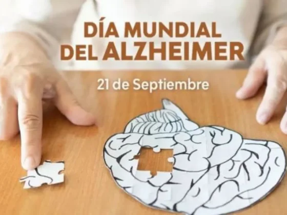 Esta es principal manifestación del Alzheimer es el trastorno de la memoria
