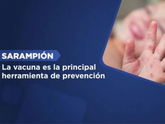Sarampión: la vacuna es la principal herramienta de prevención
