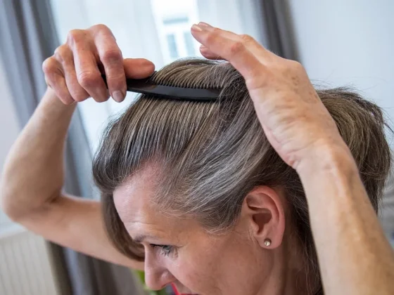 Adiós a las canas: el método natural para taparlas sin tintura y con dos ingredientes que tenés en casa