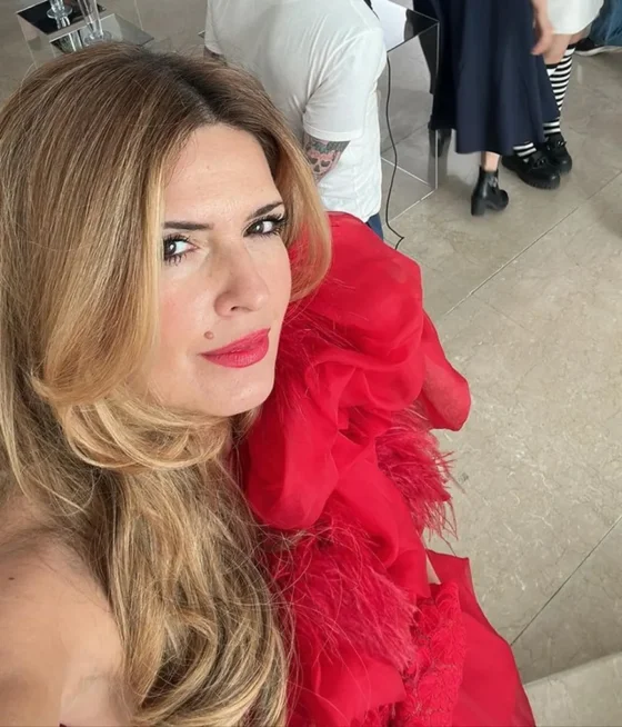 Las fotos del rostro desfigurado de Isabel Macedo que sorprenden a todos: “La angustia que tengo”