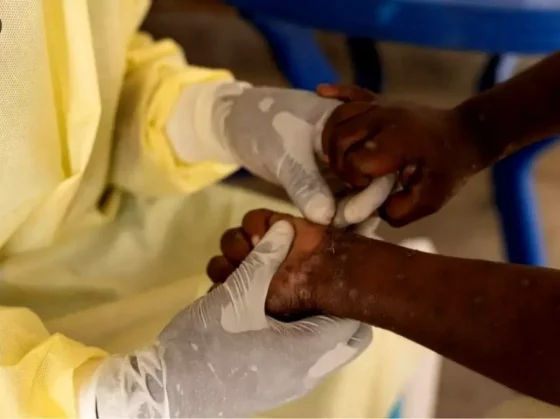 Mueren más de 70 personas por una enfermedad desconocida en la República Democrática del Congo