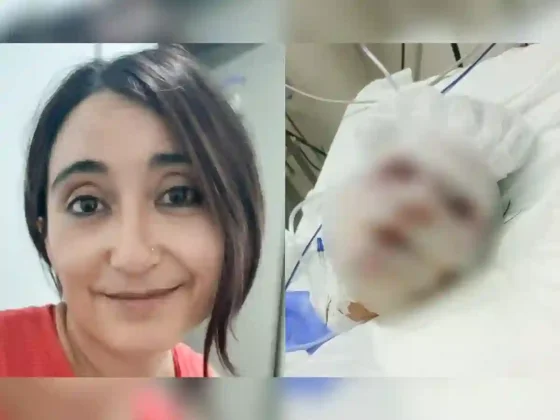Motochorros la arrastraron cuatro cuadras para robarle, le desfiguraron la cara y está viva de milagro