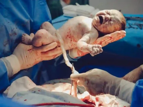 Baja constante de nacimientos en el hospital Materno Infantil