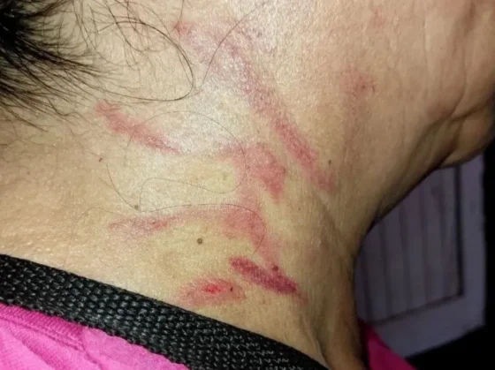 Abuelita salteña fue agredida por su hija y su ex nuera