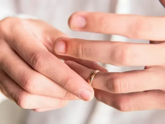Adiós al dolor: cómo sacar un anillo del dedo hinchado y no sufrir en el intento
