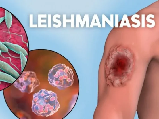 Avanzan los esfuerzos para la investigación y tratamiento de la Leishmaniasis