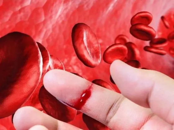 La hemofilia es hereditaria pero no contagiosa y dura toda la vida
