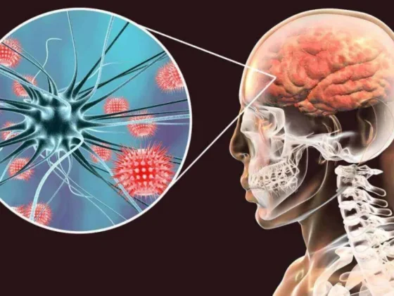 La meningitis es una enfermedad que se puede prevenir con vacuna