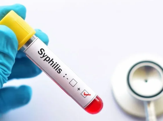 Alarma por el aumento histórico de sífilis en Argentina