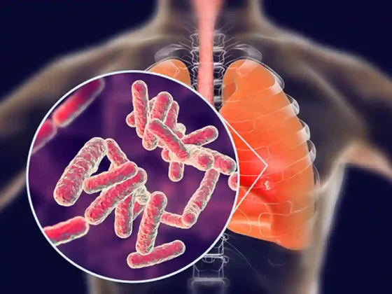 Salta registra una de las tasas de tuberculosis más elevadas del país