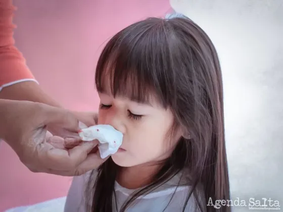 “La epistaxis, como cualquier cuadro hemorrágico, asusta mucho. Si bien en la mayoría de los casos el cuadro cede de manera espontánea, para los especialistas en otorrinolaringología es siempre una emergencia”